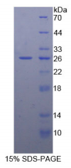 B-细胞淋巴瘤因子2(Bcl2)重组蛋白