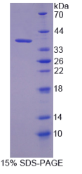 Kelch样ECH关联蛋白1(KEAP1)重组蛋白