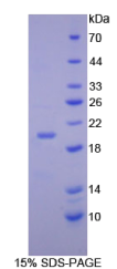 CCAAT增强子结合蛋白γ(CEBPγ)重组蛋白