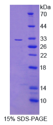 C-Ros癌基因1(ROS1)重组蛋白