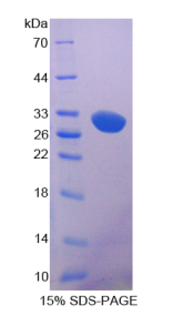 低密度脂蛋白受体相关蛋白5(LRP5)重组蛋白