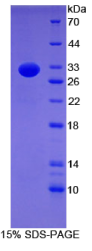 B-淋巴细胞激活抗原B7-2(LAB7-2)重组蛋白