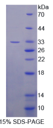 B-细胞淋巴瘤因子11A(Bcl11A)重组蛋白