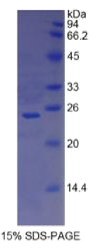 CD8a分子(CD8a)重组蛋白