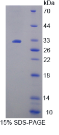 AMP激活蛋白激酶α2(PRKAα2)重组蛋白