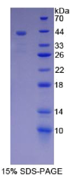 粘蛋白5B(MUC5B)重组蛋白