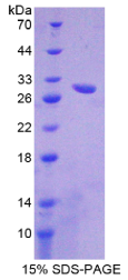 ATP结合盒转运蛋白B11(ABCB11)重组蛋白