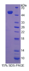 真核翻译延伸因子1γ(EEF1γ)重组蛋白