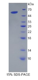 CD8a分子(CD8a)重组蛋白