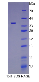 转化生长因子β3(TGFβ3)重组蛋白