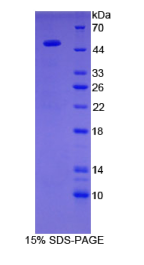 半乳糖-3-O-磺基转移酶1(GAL3ST1)重组蛋白