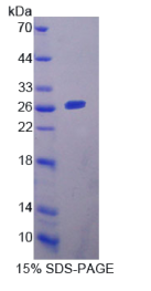 YY1关联因子2(YAF2)重组蛋白