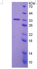 肿瘤蛋白p53(TP53)重组蛋白