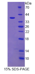 白介素12B(IL12B)重组蛋白