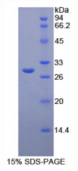 B-细胞淋巴瘤因子3(Bcl3)重组蛋白