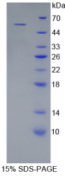 Ⅳ型胶原α3(COL4α3)重组蛋白