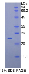 CD8b分子(CD8b)重组蛋白