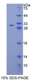 ATP结合盒转运蛋白C6(ABCC6)重组蛋白
