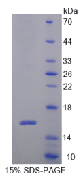 Cytospin B蛋白(CYTSB)重组蛋白
