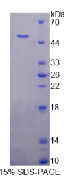 假尿苷酸合酶1(PUS1)重组蛋白