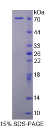 信号转导衔接分子2(STAM2)重组蛋白
