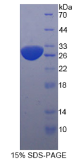 死骨片1(SQSTM1)重组蛋白