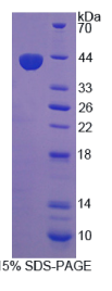 前蛋白转化酶枯草溶菌素5(PCSK5)重组蛋白