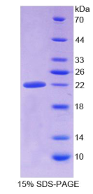 醛脱氢酶1家族成员A3(ALDH1A3)重组蛋白