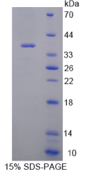 前蛋白转化酶枯草溶菌素1(PCSK1)重组蛋白