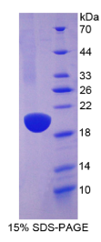 水通道蛋白4(AQP4)重组蛋白