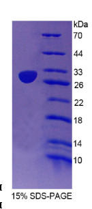 信号淋巴细胞激活分子家族成员2(SLAMF2)重组蛋白