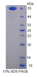 膜联蛋白A9(ANXA9)重组蛋白