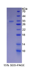 连环蛋白α1(CTNNα1)重组蛋白