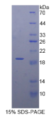 蓬乱蛋白Dsh同源物1(DVL1)重组蛋白