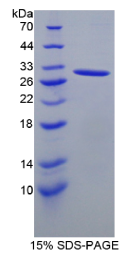 信号淋巴细胞激活分子家族成员5(SLAMF5)重组蛋白