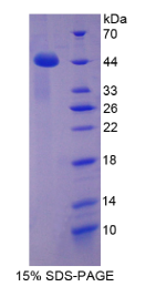 趋化因子C-C-基元配体16(CCL16)重组蛋白