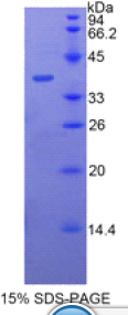 杀菌性/通透性增加蛋白(BPI)重组蛋白