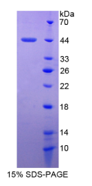 血清淀粉样蛋白A4(SAA4)重组蛋白