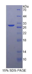 钠/钾离子转运ATP酶β3肽(ATP1β3)重组蛋白