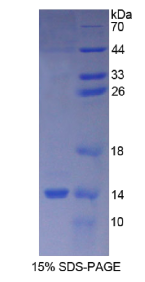 绒毛膜促性腺激素β肽1(CGβ1)重组蛋白