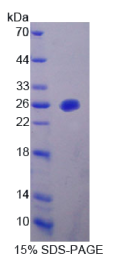 线粒体肿瘤抑制因子1(MTUS1)重组蛋白