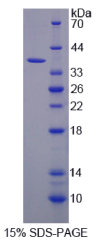 醛脱氢酶3家族成员A1(ALDH3A1)重组蛋白