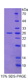 信号淋巴细胞激活分子家族成员2(SLAMF2)重组蛋白