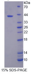 溶质载体家族39成员6(SLC39A6)重组蛋白
