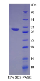 趋化因子C-X3-C-基元配体1(CX3CL1)重组蛋白