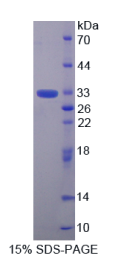 耐扭蛋白1B(TOR1B)重组蛋白