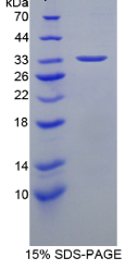 热休克转录因子4(HSF4)重组蛋白
