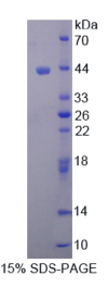 肌动蛋白γ1(ACTγ1重组蛋白
