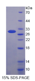 乳腺癌易感蛋白2(BRCA2)重组蛋白