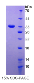 生长关联蛋白43(GAP43)重组蛋白